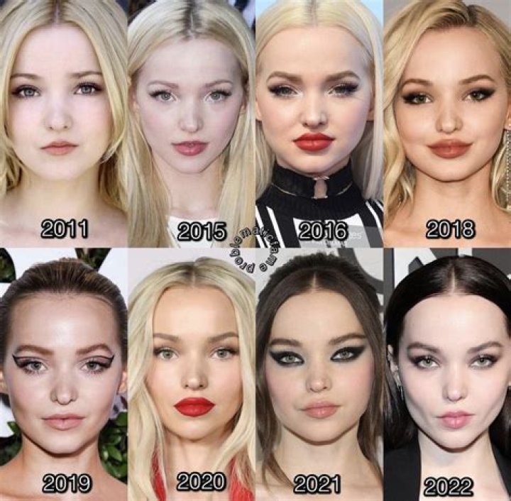 Is Dove Cameron Really Transgender? Find Out The Truth Behind The Rumors