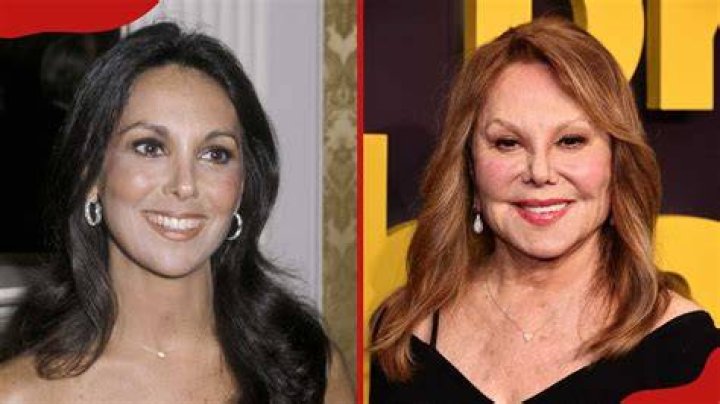 Marlo Thomas Plastic Surgery Before And After Transformation