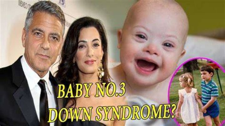 Meet The Inspiring Children Of George Clooney: Down Syndrome Champions