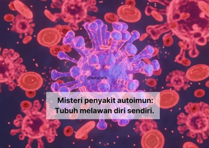 Merungkai Misteri Penyakit “Systemic Lupus Erythematosus” (SLE