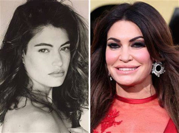 The Transformation Of Guilfoyle: A Before-and-After Journey